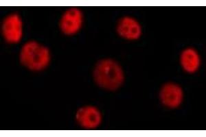 ABIN6277385 staining Hela cells by IF/ICC. (HOXC8 抗体  (Internal Region))