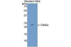 Detection of Recombinant ADCYAP1, Mouse using Polyclonal Antibody to Pituitary Adenylate Cyclase Activating Peptide (PACAP) (Pituitary Adenylate Cyclase Activating Peptide (AA 1-175) 抗体)