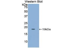 Western blot analysis of the recombinant protein. (PLGF 抗体  (AA 43-162))