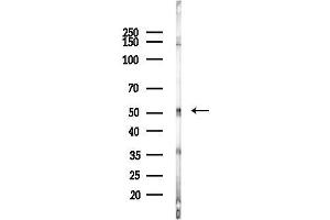 Western blot analysis of lysates from F10-LUC cells(starvation,24h treatment), using Nuclear factor 1 C-type Antibody at 1/1000 dilution.