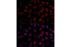 Immunofluorescence analysis of L929 cells using PDE11A antibody (ABIN7269298) at dilution of 1:100. (PDE11A 抗体  (AA 712-933))