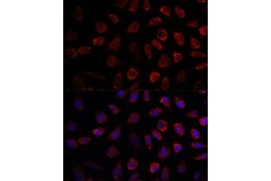Immunofluorescence analysis of L929 cells using PDE11A antibody (ABIN7269298) at dilution of 1:100. (PDE11A 抗体  (AA 712-933))