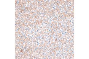 Immunohistochemistry of paraffin-embedded rat ovary using PMEP antibody (6555) at dilution of 1:100 (40x lens). (PMEPA1 抗体  (AA 173-252))