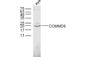 Mouse eye lysates probed with COMMD8 Polyclonal Antibody, unconjugated  at 1:300 overnight at 4°C followed by a conjugated secondary antibody at 1:10000 for 60 minutes at 37°C. (COMMD8 抗体  (AA 101-183))