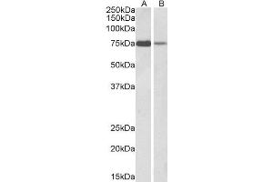 ABIN2564849 (1µg/ml) staining of K562 (A) and Jurkat (B) lysate (35µg protein in RIPA buffer). (RACGAP1 抗体  (C-Term))