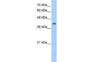 WB Suggested Anti-POMT2 Antibody Titration:  0. (POMT2 抗体  (Middle Region))