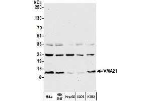 Western Blotting (WB) image for anti-Vacuolar H+-ATPase Homolog (VMA21) (AA 51-101) antibody (ABIN7452645) (VMA21 抗体  (AA 51-101))