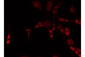 ABIN6274909 staining HeLa by IF/ICC. (B4GALNT1 抗体  (Internal Region))