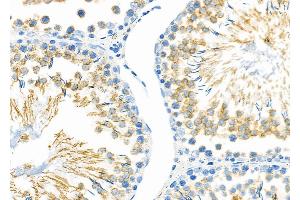 ABIN6257707 and ABIN6274332 at 1/100 staining Rat testis tissue by IHC-P. (CHAF1A 抗体  (N-Term))