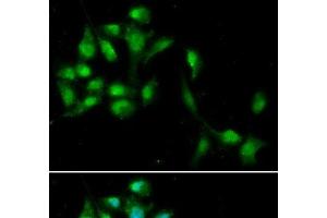 Immunofluorescence analysis of A549 cells using HEXIM1 Polyclonal Antibody (HEXIM1 抗体)