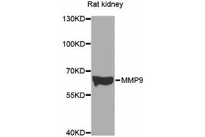 Western blot analysis of extracts of various cell lines, using MMP9 antibody (ABIN4904401) at 1:500 dilution. (MMP 9 抗体)
