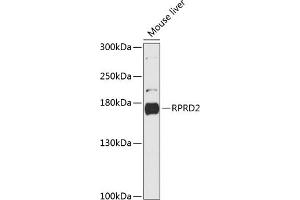 Western blot analysis of extracts of mouse liver, using RPRD2 antibody (ABIN6130674, ABIN6147187, ABIN6147188 and ABIN6216935) at 1:3000 dilution. (RPRD2 抗体  (AA 1-350))