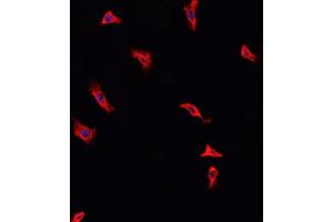 ABIN6268986 staining HeLa cells by IF/ICC. (Annexin A2 抗体  (pSer26))