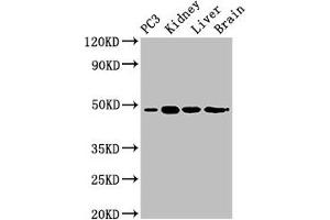 Western Blot Positive WB detected in: PC-3 whole cell lysate, Mouse kidney tissue, Mouse liver tissue, Rat brain tissue All lanes: ACP6 antibody at 3 μg/mL Secondary Goat polyclonal to rabbit IgG at 1/50000 dilution Predicted band size: 49, 31 kDa Observed band size: 49 kDa (ACP6 抗体  (AA 35-324))