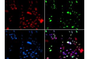 Immunofluorescence analysis of GFP-RNF168 transgenic U2OS cells using PIAS1 antibody (ABIN5973357). (PIAS1 抗体)