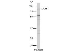 Mouse testis lysates probed with Rabbit Anti-COMP Polyclonal Antibody, Unconjugated  at 1:5000 for 90 min at 37˚C. (COMP 抗体)