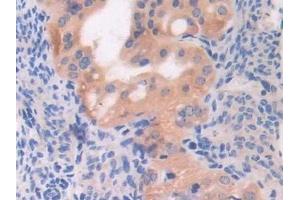 Immunohistochemistry (IHC) image for anti-Chromosome 6 Open Reading Frame 150 (C6orf150) (AA 211-395) antibody (ABIN7443491)