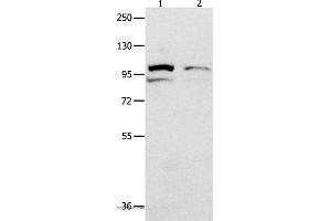 Western blot analysis of 231 cell  and mouse kidney tissue  , using MVP Polyclonal Antibody at dilution of 1:500 (MVP 抗体)