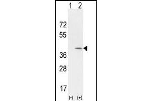 Western blot analysis of CCND1 (arrow) using rabbit polyclonal CCND1 Antibody (Center) (Cat. (Cyclin D1 抗体  (AA 147-175))