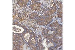 IHC analysis of SEC31A using anti-SEC31A antibody (ABIN7599630).