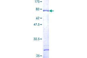 SNX15 Protein (AA 1-342) (GST tag)