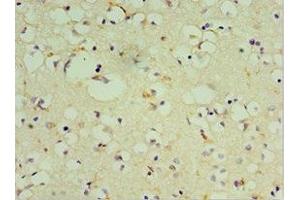 Immunohistochemistry of paraffin-embedded human brain tissue using ABIN7149475 at dilution of 1:100 (DRD3 抗体  (AA 213-329))