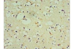 Immunohistochemistry of paraffin-embedded human brain tissue using ABIN7149475 at dilution of 1:100 (DRD3 抗体  (AA 213-329))