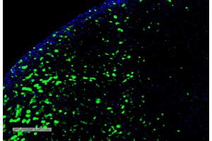Immunohistochemistry analysis using Mouse Anti-Hexanoyl-Lysine adduct Monoclonal Antibody, Clone 5D9 (ABIN5067237). (Hexanoyl-Lysine Adduct (HEL) 抗体 (Atto 488))