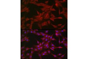 Immunofluorescence analysis of PC-12 cells using SOCS3 Rabbit pAb (ABIN3015316, ABIN3015317, ABIN5663764 and ABIN6213984) at dilution of 1:50 (40x lens). (SOCS3 抗体  (C-Term))