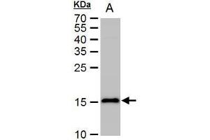 WB Image LC3B antibody detects LC3B protein by western blot analysis.
