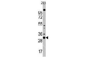 Western blot analysis of CDC2 polyclonal antibody  in 293 cell line lysates (35 ug/lane). (CDK1 抗体  (N-Term))