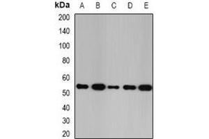 Western blot analysis of Glutathione Synthetase expression in SW480 (A), K562 (B), Raji (C), mouse kidney (D), mouse liver (E) whole cell lysates. (Glutathione Synthetase 抗体)