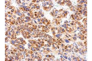 Immunohistochemistry (IHC) image for anti-Chemokine (C-X-C Motif) Receptor 1 (CXCR1) (C-Term) antibody (ABIN2854740)