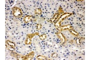 IHC-P: Presenilin 2 antibody testing of rat kidney tissue (Presenilin 2 抗体  (N-Term))