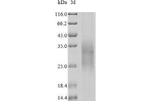 Triggering Receptor Expressed On Myeloid Cells 2 (TREM2) (AA 19-174) (Active) protein (His tag,MYC tag)