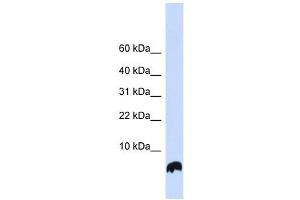 GLRX antibody used at 1 ug/ml to detect target protein. (Glutaredoxin 1 抗体)