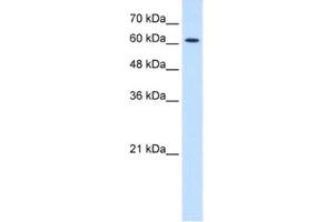 Western Blotting (WB) image for anti-Cholinergic Receptor, Nicotinic, epsilon (Muscle) (CHRNE) antibody (ABIN2463737) (CHRNE 抗体)