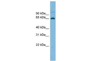WB Suggested Anti-TRIM25 Antibody Titration: 0. (TRIM25 抗体  (Middle Region))