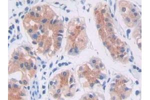 Detection of PLCg1 in Human Stomach Tissue using Polyclonal Antibody to Phospholipase C Gamma 1 (PLCg1)