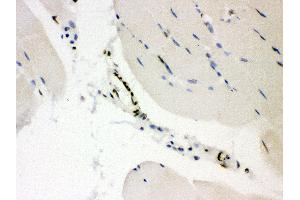 Anti-CTBP2 Picoband antibody, IHC(P) IHC(P): Mouse Skeletal Muscle Tissue (CTBP2 抗体  (AA 321-445))