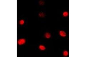 Immunofluorescent analysis of TBX1 staining in Jurkat cells. (T-Box 1 抗体  (C-Term))