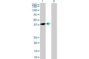 Western Blot analysis of BCL7C expression in transfected 293T cell line by BCL7C MaxPab polyclonal antibody. (BCL7C 抗体  (AA 1-217))