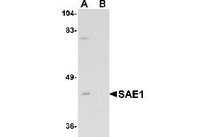 Western blot analysis of SAE1 in SK-N-SH lysate with SAE1 antibody at 1 µg/mL in (A) the absence and (B) the presence of blocking peptide. (SAE1 抗体  (C-Term))