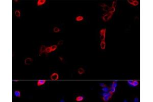 Immunofluorescence analysis of NIH/3T3 cells using ATP5B Polyclonal Antibody at dilution of 1:100 (40x lens). (ATP5B 抗体)