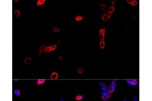 Immunofluorescence analysis of NIH/3T3 cells using ATP5B Polyclonal Antibody at dilution of 1:100 (40x lens). (ATP5B 抗体)