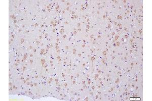 Formalin-fixed and paraffin embedded rat brain labeled with Anti-NF2/Neurofibromin 2 Polyclonal Antibody, Unconjugated  at 1:200 followed by conjugation to the secondary antibody and DAB staining (Merlin 抗体  (AA 401-550))