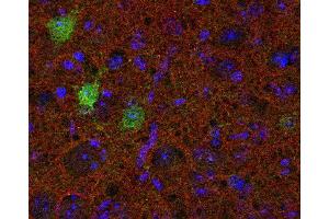 Indirect immunolabeling of PFA fixed mouse cortex section with anti-SV2 B (dilution 1 : 200; red) and guinea pig anti-calbindin (cat. (SV2B 抗体  (AA 2-17))