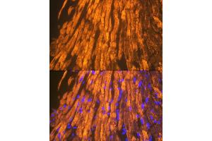 Immunofluorescence analysis of mouse heart using  Rabbit mAb (ABIN7265397) at dilution of 1:100 (40x lens). (ACTN2 抗体)
