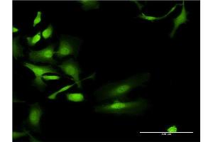 Immunofluorescence of monoclonal antibody to UGT2B4 on HeLa cell. (UGT2B4 抗体  (AA 25-124))