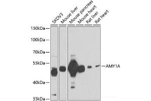 Western blot analysis of extracts of various cell lines using AMY1A Polyclonal Antibody at dilution of 1:1000. (AMY1A 抗体)